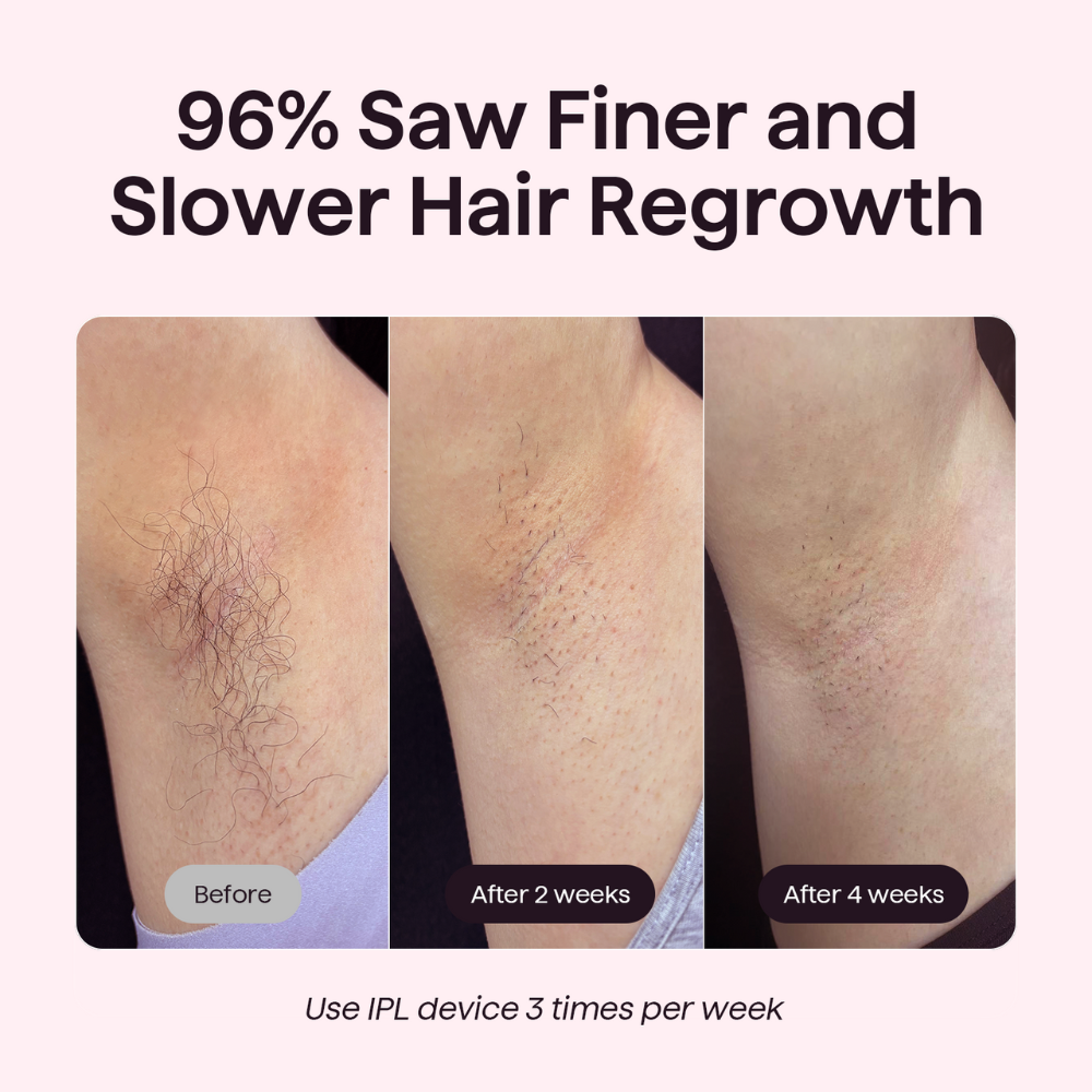 Bare It Without Roller